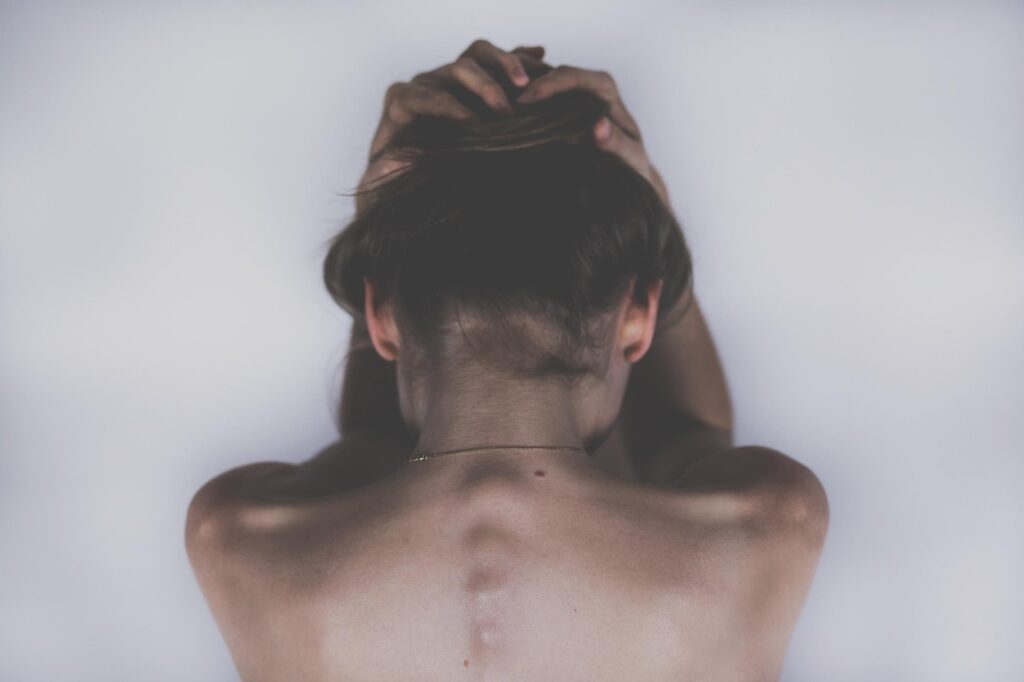 敏感肌の人がワキガにボトックスを使う際の痛みとダウンタイムはどのくらい？
